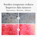 [Subscr.] Red Succinic Acid Panthenol Pads